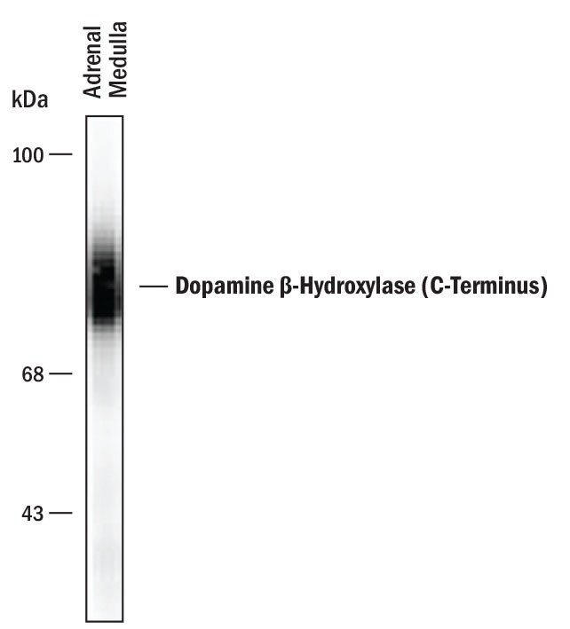 Detection of Dopamine  beta -Hydroxylase (C-Terminus) antibody by Western Blot.