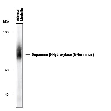 Detection of Dopamine  beta ‑Hydroxylase (N-Terminus).