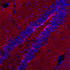 Doublecortin/DCX antibody in Mouse Brain by Immunohistochemistry (IHC-Fr).