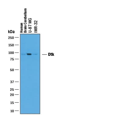 Detection of Human Tyro3/Dtk antibody by Western Blot.