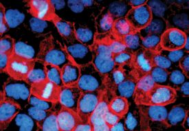 E‑Cadherin antibody in Human Epidermoid Carcinoma Cells by Immunocytochemistry (ICC).