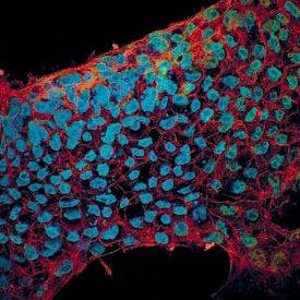 E‑Cadherin and SOX2 antibody in BG01V Human Stem Cells by Immunocytochemistry (ICC).