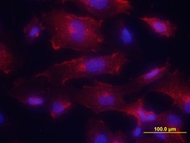 E-Selectin/CD62E antibody in HUVEC Human Cells by Immunocytochemistry (ICC).