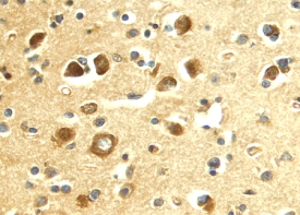 E‑Selectin/CD62E antibody in Human Brain by Immunohistochemistry (IHC-P).