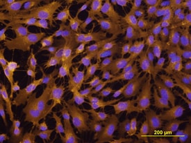 E-Selectin/CD62E antibody in HUVEC Cells by Immunocytochemistry (ICC).