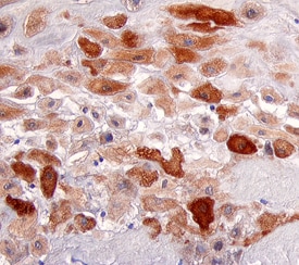 E2F‑1 antibody in Human Placenta by Immunohistochemistry (IHC-P).