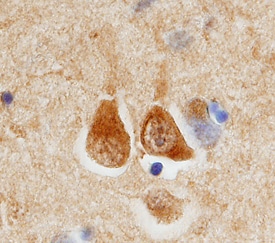 ECE‑2 antibody in Human Brain by Immunohistochemistry (IHC-P).