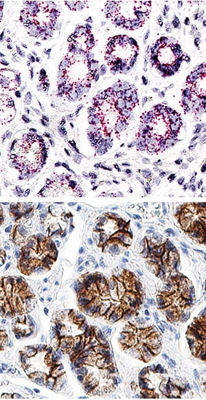 E-Cadherin antibody in Human Stomach Using Dual RNAscope®ISH and IHC.