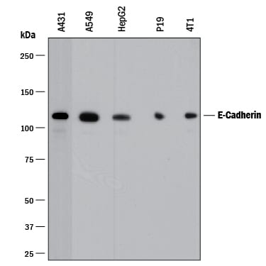 Detection of Human and Mouse E-Cadherin antibody by Western Blot.