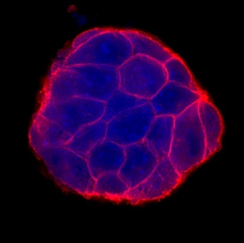 E-Cadherin antibody in D3 Mouse Embryonic Stem Cell Line by Immunocytochemistry (ICC).