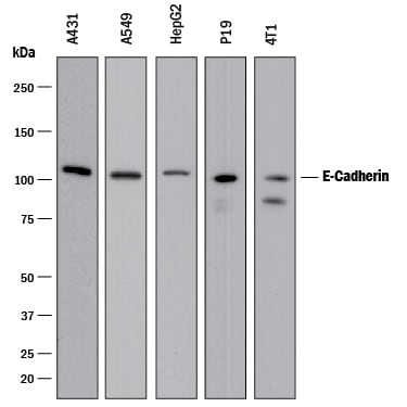 Detection of Human and Mouse E-Cadherin antibody by Western Blot.