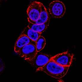 E-Cadherin antibody in MCF-7 Human Cell Line by Immunocytochemistry (ICC).