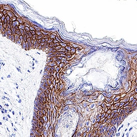 E-Cadherin antibody in Human Skin by Immunohistochemistry (IHC-P).