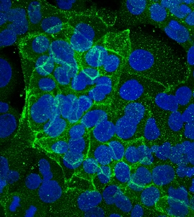 E-Cadherin antibody in PANC-1 Human Cell Line by Immunocytochemistry (ICC).