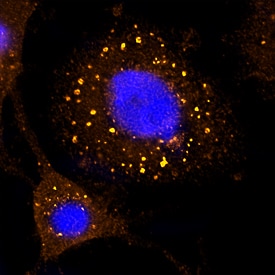 EEA1 antibody in HeLa Human Cell Line by Immunocytochemistry (ICC).