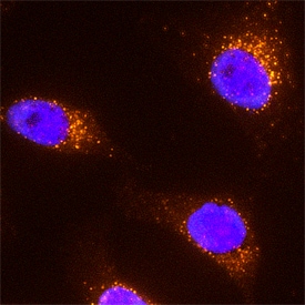 EEA1 antibody in HeLa Human Cell Line by Immunocytochemistry (ICC).