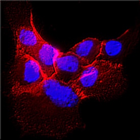 EGFR antibody in A431 Human Cell Line by Immunocytochemistry (ICC).