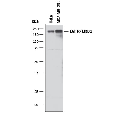 Detection of Human EGFR antibody by Western Blot.