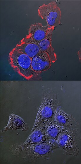 Phospho-EGFR (Y869) antibody in A431 Human Cell Line by Immunocytochemistry (ICC).