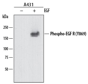 Detection of Human Phospho-EGFR (Y869) antibody by Western Blot.