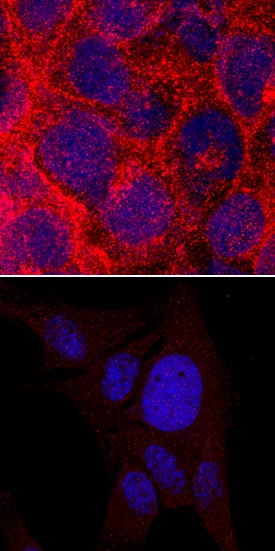 EGFR (aa 746-750 deletion) antibody in HCC827 Human Cell Line by Immunocytochemistry (ICC).