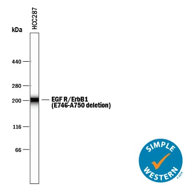 Detection of Human EGFR antibody by Simple WesternTM.