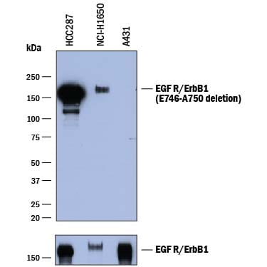 Detection of Human EGFR (aa 746-750 deletion) antibody by Western Blot.