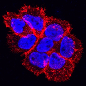 EGFR antibody in A431 Human Cell Line by Immunocytochemistry (ICC).