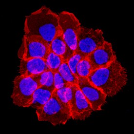 Phospho-EGFR (Y1086) antibody in A431 Human Cell Line by Immunocytochemistry (ICC).