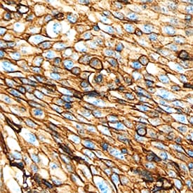 EMMPRIN/CD147 antibody in Human Cervix by Immunohistochemistry (IHC-P).