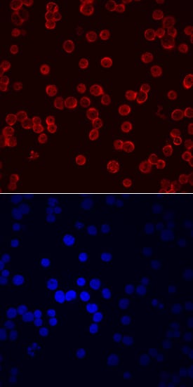 EMP/MAEA antibody in Jurkat Human Cell Line by Immunocytochemistry (ICC).