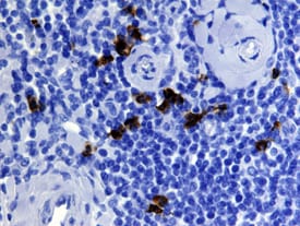 EN‑RAGE/S100A12 antibody in Human Tonsil by Immunohistochemistry (IHC-P).