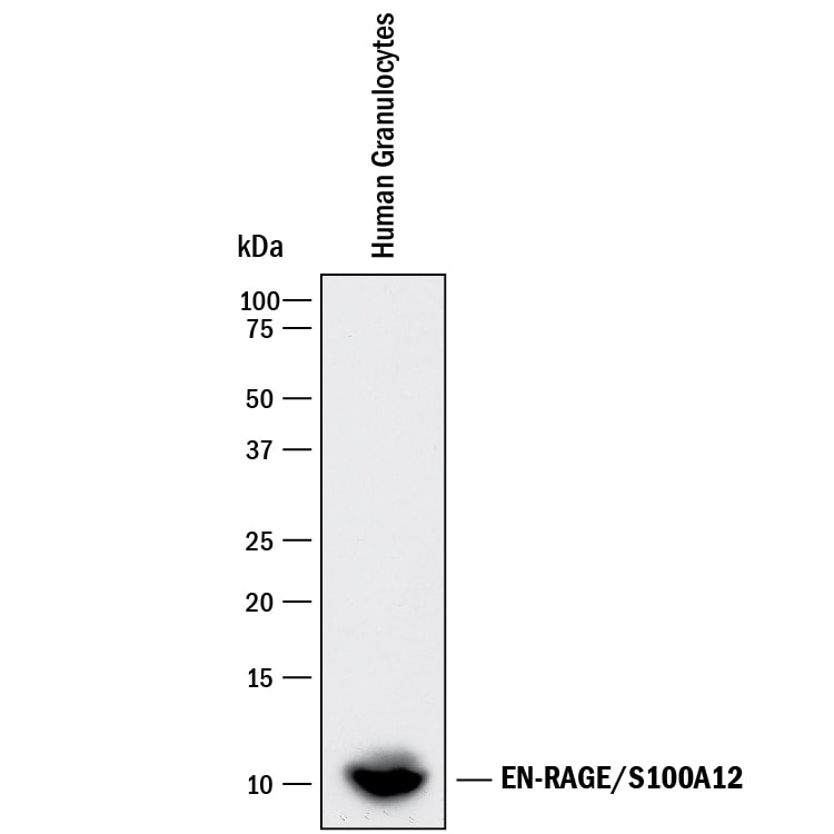 Detection of Human EN-RAGE/S100A12 antibody by Western Blot.
