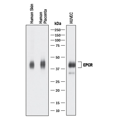 Detection of Human EPCR antibody by Western Blot.