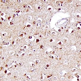 ERK1/ERK2 antibody in Human Brain by Immunohistochemistry (IHC-P).