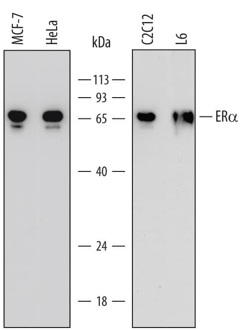 Detection of Human, Mouse, and Rat ERa/NR3A1 antibody by Western Blot.
