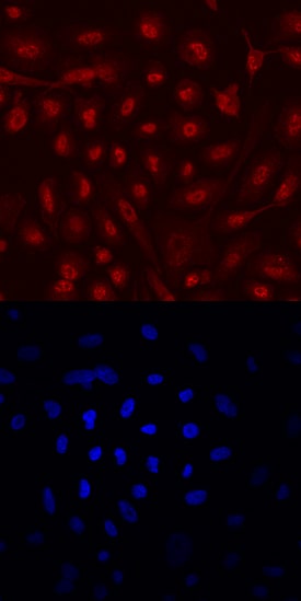 ERa/NR3A1 antibody in PC-3 Human Cell Line by Immunocytochemistry (ICC).