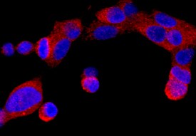 ER beta /NR3A2 antibody in LNCaP Human Cell Line by Immunocytochemistry (ICC).