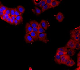 ER beta /NR3A2 antibody in MCF-7 Human Cell Line by Immunocytochemistry (ICC).
