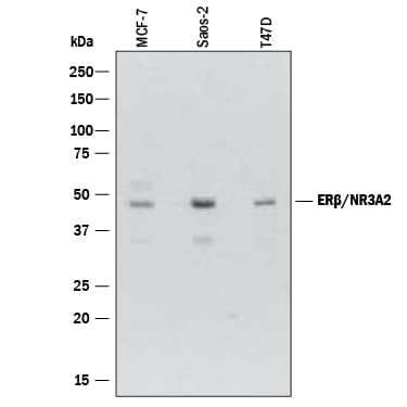 Detection of Human ER beta /NR3A2 antibody by Western Blot.