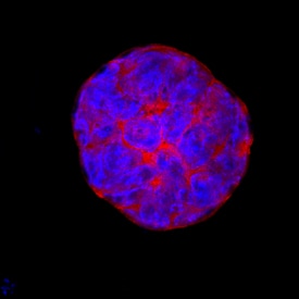 ESGP antibody in D3 Mouse Cell Line by Immunocytochemistry (ICC).