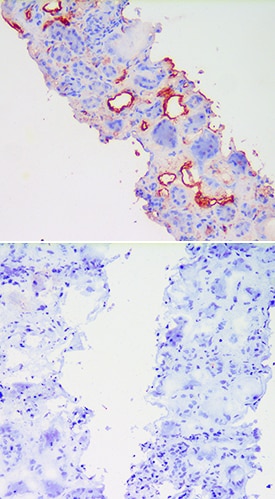 E-Selectin/CD62E antibody in LPS treated Human Kidney Tissue.
