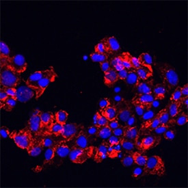 E-Selectin/CD62E antibody in HUVECs by Immunocytochemistry (ICC).