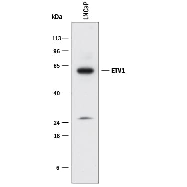 Detection of Human ETV1 antibody by Western Blot.