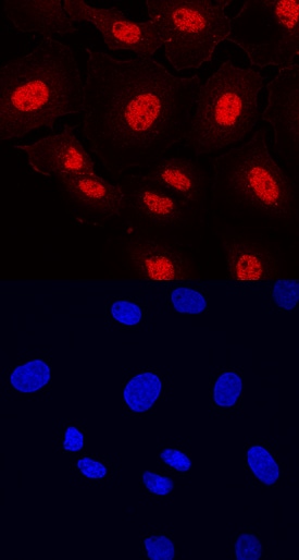 ETV5 antibody in BT-20 Human Cell Line by Immunocytochemistry (ICC).