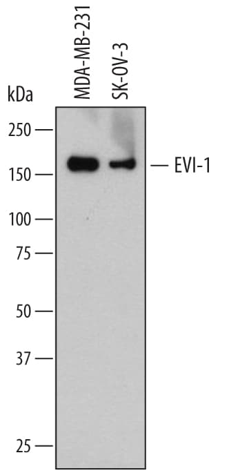 Detection of Human EVI-1 antibody by Western Blot.