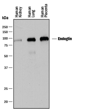 Detection of Human Endoglin/CD105 antibody by Western Blot.