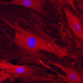 Endoglin/CD105 antibody in Rat Mesenchymal Stem Cells by Immunocytochemistry (ICC).