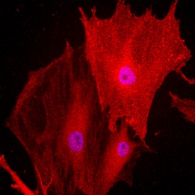 Endoglin/CD105 antibody in Rat Mesenchymal Stem Cells by Immunocytochemistry (ICC).