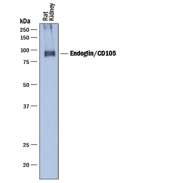 Detection of Rat Endoglin/CD105 antibody by Western Blot.